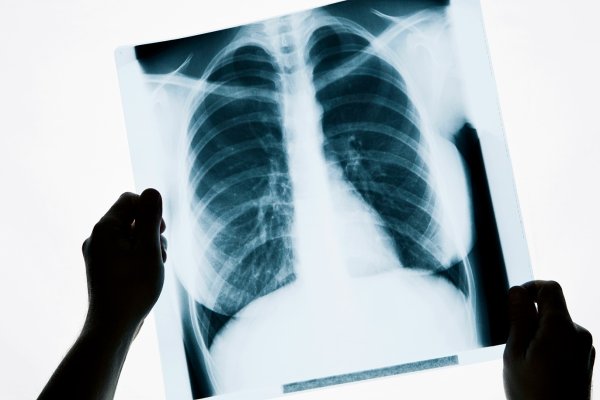 Ссылки в тор